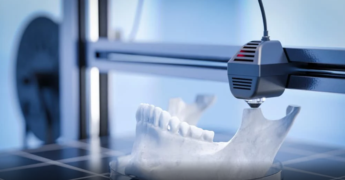 Ekran goruntusu 2024 01 07 154047 - 3D Baskı Nedir