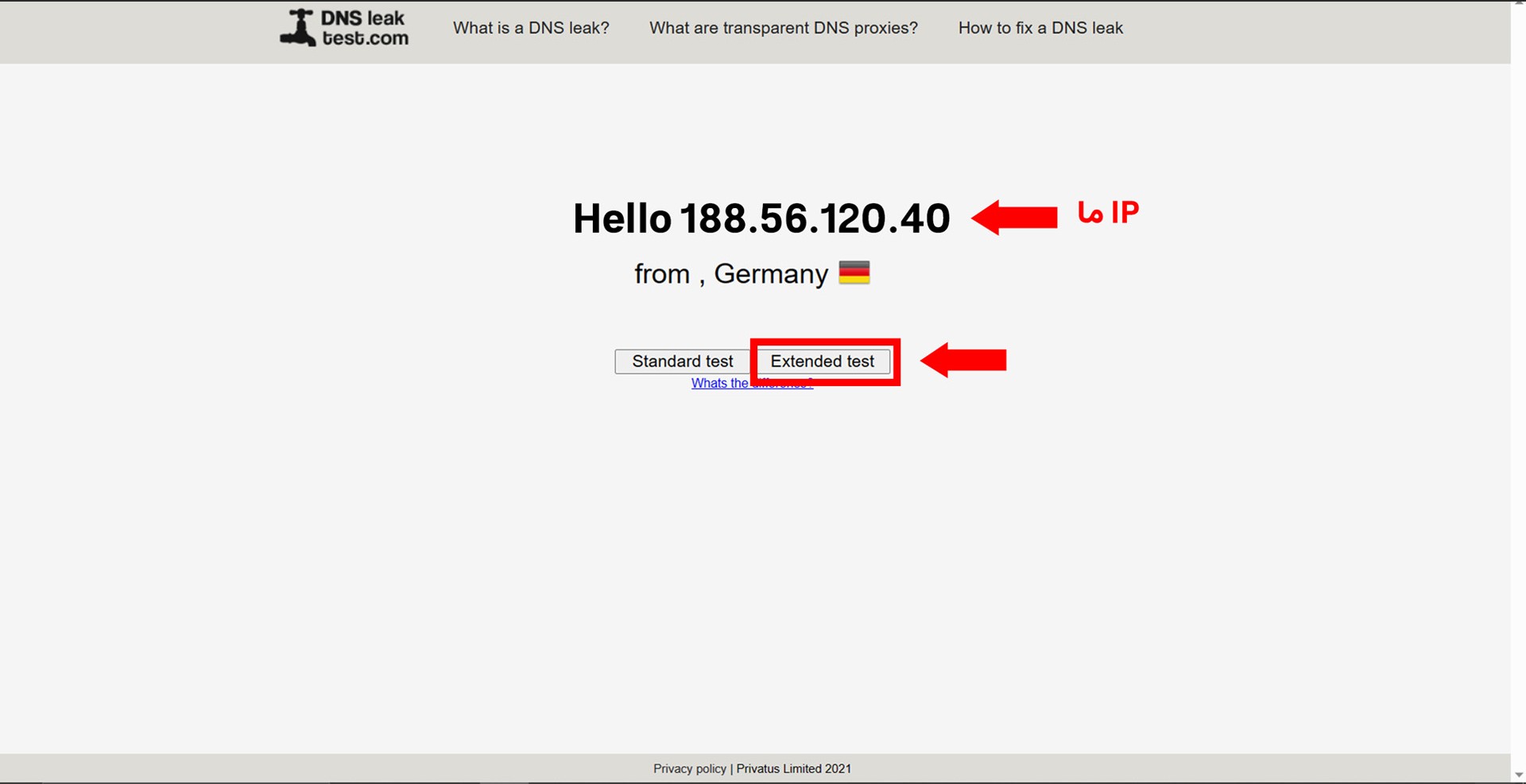 Bir web tarayıcısında açık bir DNS sızıntı testi sayfası, DNS sunucu bilgilerini ve IP adresini gösteriyor.