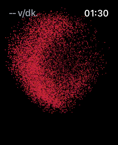 Apple Watch Ultra'da EKG Nasıl Çekilir incoming 6E858FF7 2F4B 4966 B636 75170B8C5582 - Apple Watch Ultra'da EKG Nasıl Çekilir