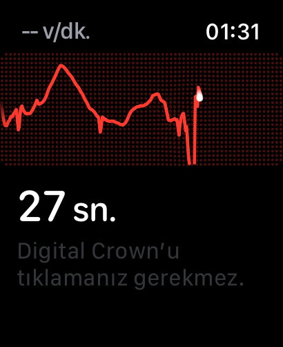 Apple Watch Ultra'da EKG Nasıl Çekilir Apple Watch Ultra'da EKG Nasıl Çekilir