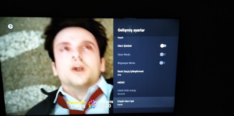 4K TV de görüntü kalitesi neden düşük görünüyor çözümü varmıdır